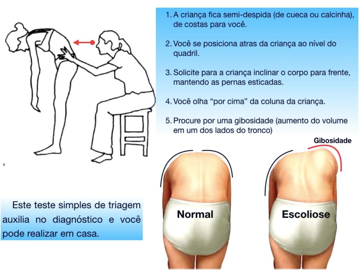 O Que Teste De Adam Anatomia Humana I